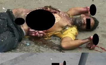 Explotó granada que llevaba en el koala, se le salieron las tripas y le arrancó las manos explotó granada tripas - noticias de hoy